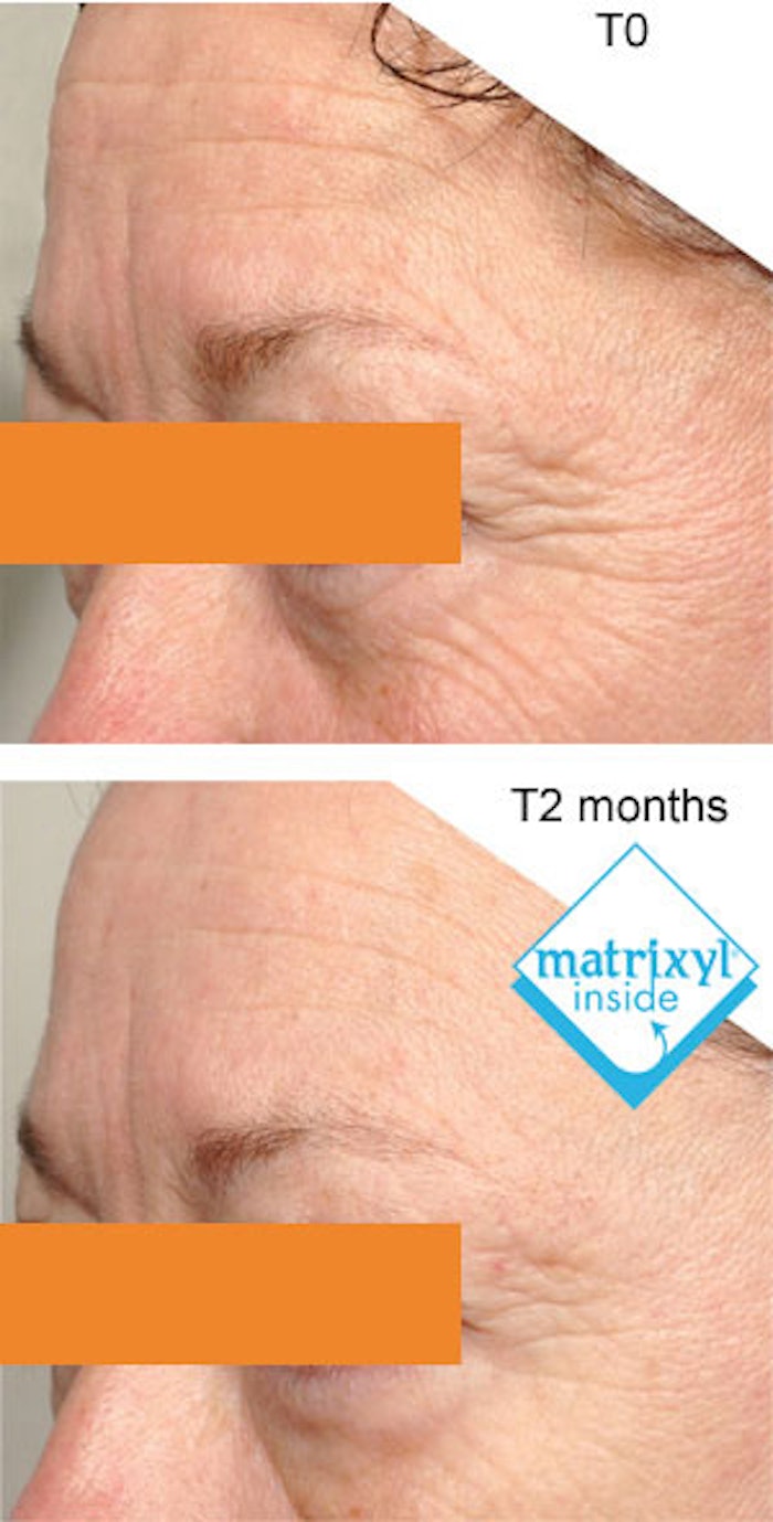 sedermaSponsorContent