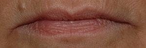 Volulip T0