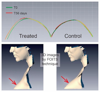 Volufiline Foits