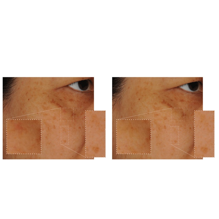 MediatoneSederma_GCI1511_850