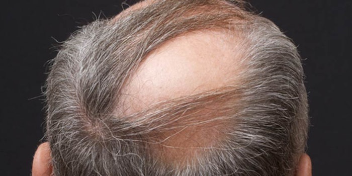 Hair Regrowth Propelling New Growth in Beauty Devices | Global Cosmetic Industry Hair Regrowth Propelling New Growth in Beauty Devices | Global Cosmetic Industry