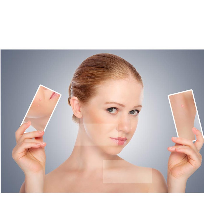 850_womanwithskincarephoto_p1