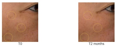 Effects of splash masks