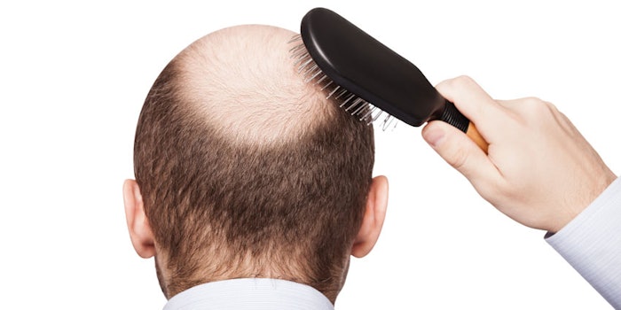 hairloss850x425