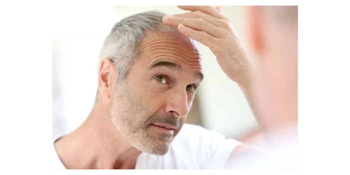 Baldness850x425