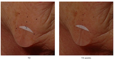 Anti_Aging2 Sederma