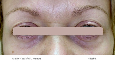 Eye Contour Sederma