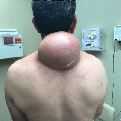 @drpimplepopper / via Instagram