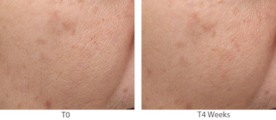 Sederma First Image