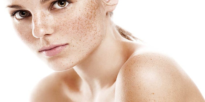 850x425_solvayincos2018