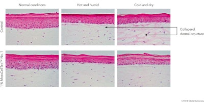 The efficacy of MossCellTec™ No.1 was also tested in a placebo-controlled clinical study on volunteers who spent more than two hours per day outside in the summer in Seoul, Korea. After just 14 days of treatment with 2% moss active, a significant improvement of skin hydration, TEWL and skin tone homogeneity compared to placebo was observed despite stressful climatic conditions.