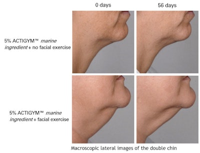 Awarded Gold at the Innovation Zone Best Ingredient Award during in-cosmetics® Asia 2014, ACTIGYM™ marine ingredient helps improve body tone and obtain a slender neck and a more defined V-shaped face.