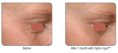 Sederma Gci1904 Image2