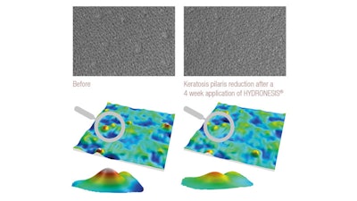 Sederma Gci1904 Image3