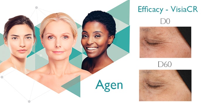 Agen---Lead-image_800x424px_v2-(1)