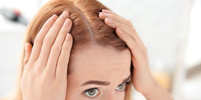 WomanExaminesScalp850x425