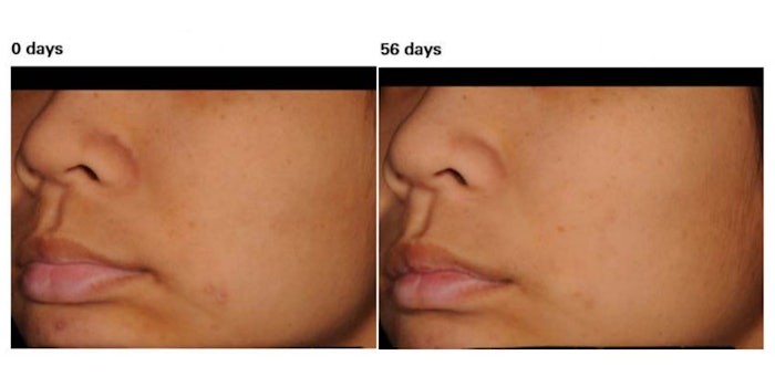 LipochromanResults850x425