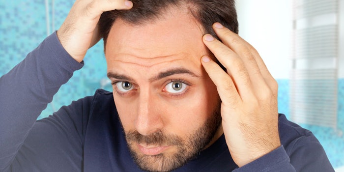 ManLookingatScalp850x425