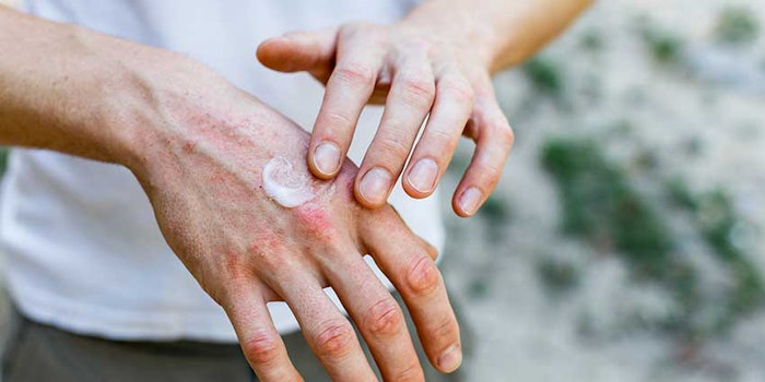 Bayer.Azitra_Partner850