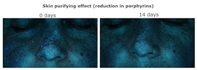 A third clinical test was carried out using the Mirror Test™ technique, with participants answering questions about their appearance while standing in front of a mirror at the beginning and end of the study. Responses were evaluated for vocal intensity and tone, demonstrating stress level about their reflection, and words used to describe their appearance. Compared to results with a benchmark clay mask, enhancement of well-being and self-perception was similar when using the Uniclay™ biotech ingredient.