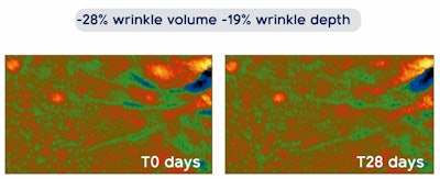 Click here to learn more about Reneseed™.