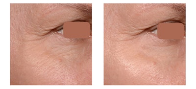 And to know more, download the presentation and the recording of our latest HYBRID MAKE-UP seminar