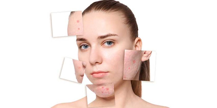 Ortho Dermatologics Arazlo