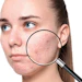 CT2010_Prod_Vevy_Europe_Spa_Azamide_850x425
