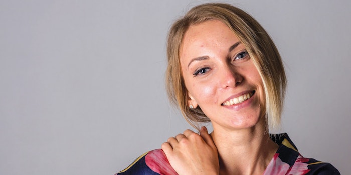 Nearly 100% of consumers say they have experienced acne at some point in their lives