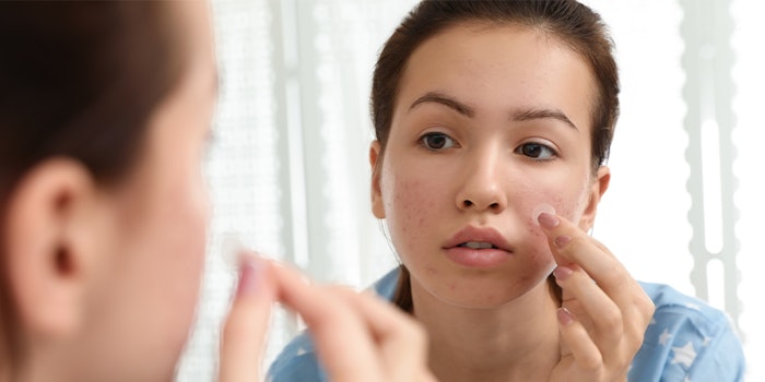 Hydrocolloid patches offer a similar element of satisfaction by extracting pimple contents in a visible, tactile way.
