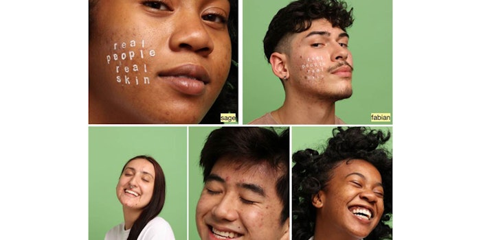 Acne Acceptance Month aims to normalize breakouts and promote skin acceptance.
