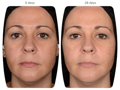 Lubrizol Gci2108 Image1