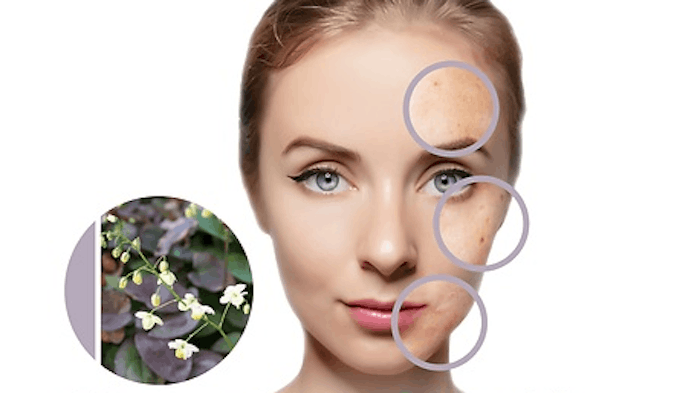 Grandiciin limits the biofilm-resident C. acnes and prevents tissue-damaging inflammation in blemish-prone skin.