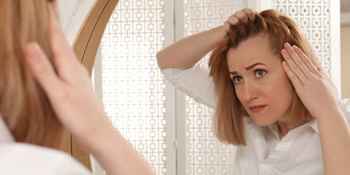 WomanScalpStressHairLossMirror_850x425