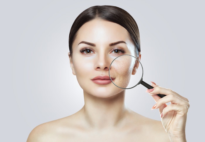 BB-Biont is a biomimetic peptide that targets the microbiome to diminish C. acnes and promote a healthy, smooth skin appearance.