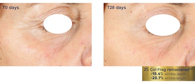 Lipotrue Gci2203 Image1