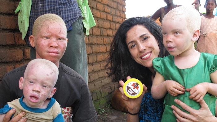 Beyond Suncare provides education and sunscreen to people with albinism living in remote locations in Africa.