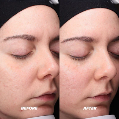 Skin Proud Launches #skinsistency Campaign | Global Cosmetic Industry