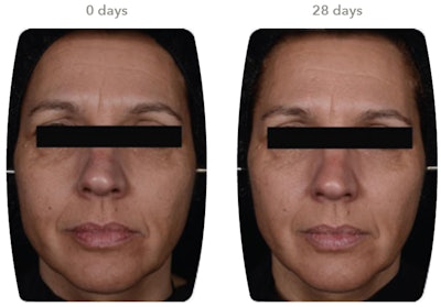 Lubrizol Gci2205 Image