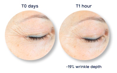 Lipotrue Gci2210 Image1