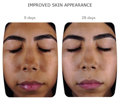 Lubrizol Gci2210 Image1