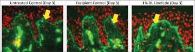 Figure 2. Effects of DL Linefade on collagen IV synthesis in human skin explants vs. untreated and excipient-treated controls after 3 Days of incubation. Collagen IV was detected by immunostaining using specific antibodies. Number of explants per condition = 3. Yellow arrows locate the dermal-epidermal junction.
