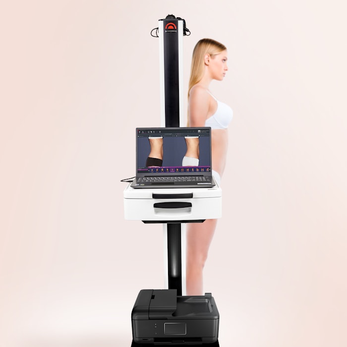 Fotofinder Bodystation Ii