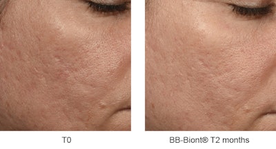 Sederma Gci2303 Image1