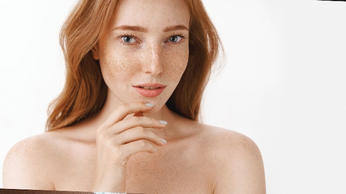 Decoding the Science Behind the Redhead Factor