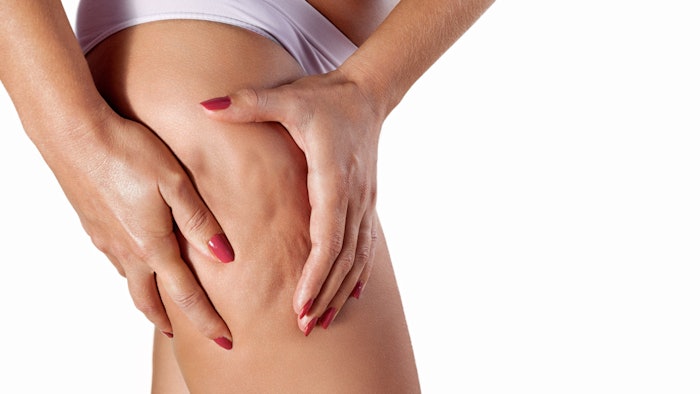 Woman squeezing her thigh to show cellulite