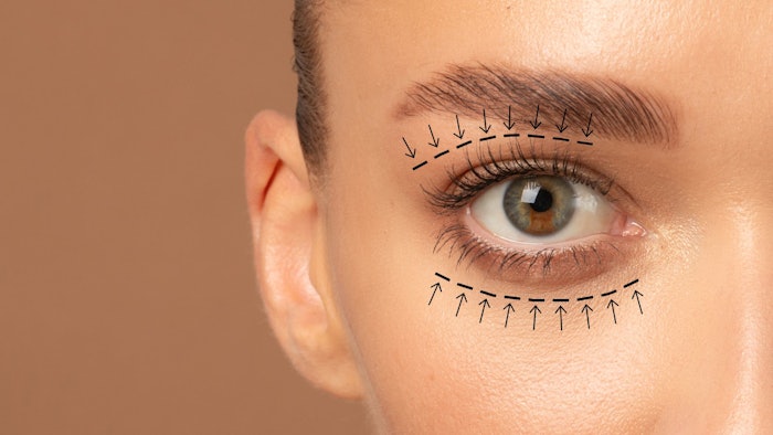 96% of readers are interested in non-invasive treatment advances for blepharoplasty procedures! Here are three exciting advances in non-invasive blepharoplasty (eyelid lift) procedures.