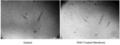 Ct2406 Dsm Advertorial Figure3