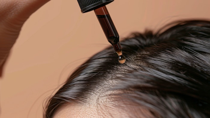 Overhead shot of dropper vitamin application on bald scalp, isolated on a clean background, well-lit studio setting, emphasizing effective hair care