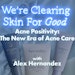 Acne Positivity video interview from Face Reality